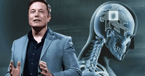 Công ty của Elon Musk được phép thử nghiệm cấy chip vào não người