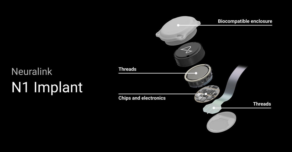 Neuralink: Điều khiển máy tính bằng não và hy vọng cho người mù